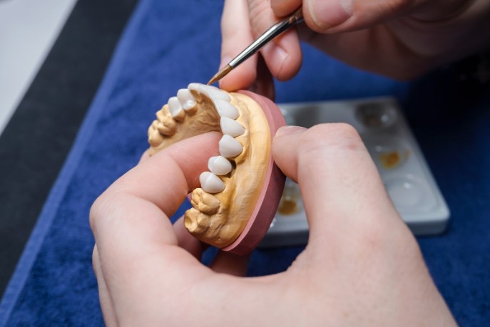 какие бывают зубные протезы плюсы и минусы